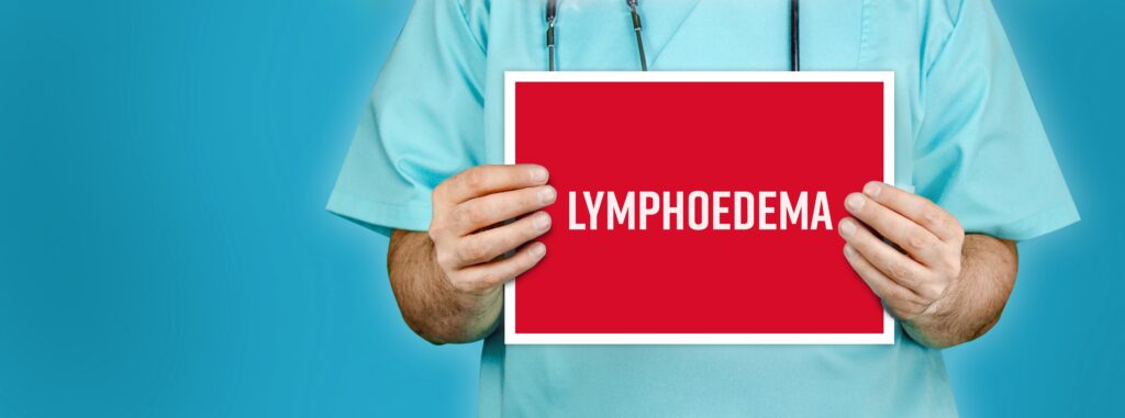 Surgical doctor holding a Lymphoedema sign. Doctor shows red sign with medical word on it. Blue background. dealing with lymphedema post surgery